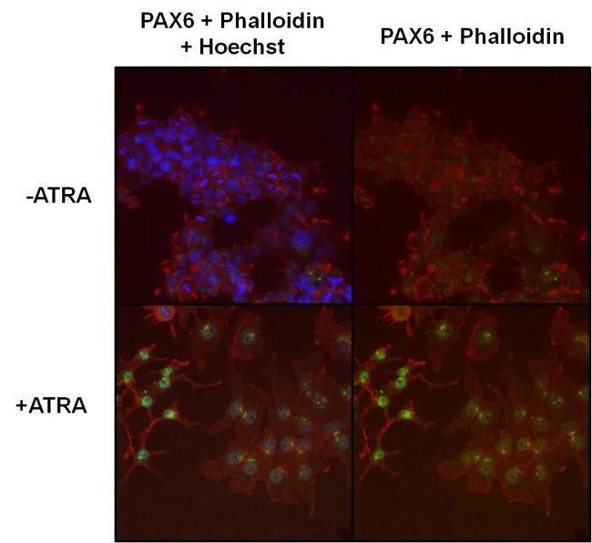 WB analysis of rat whole eye extract using GTX79189 PAX6 antibody.