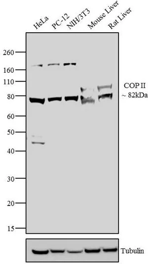 ICC/IF analysis of PC12 cells using GTX79203 SEC23A antibody. Cells were probed without (left) or with(right) an antibody.