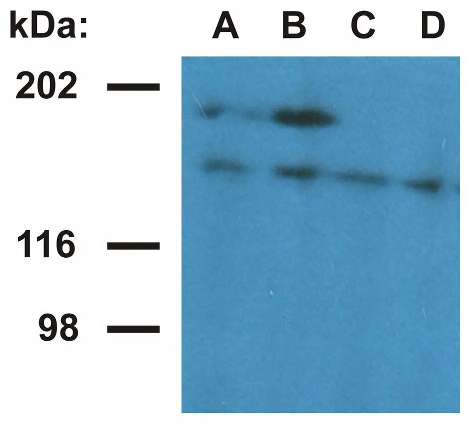 WB analysis of nuclear fraction of HeLa cells using GTX79859 Ubinuclein 1 antibody [UBN1-02]. Lane A, B : The monoclonal antibody UBN1-01 Lane C, D : GTX79859 Diultion : 1μg/ml (lane A and C) and 5μg/ml (lane B and D)