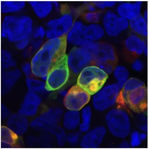 ICC/IF analysis of HEK-293 cells co-transfected with PRR7 and GFP-PSD95 using GTX79873 PRR7 antibody [TRAP3/10]. Green : PSD95 Red : Primary antibody Blue : DAPI