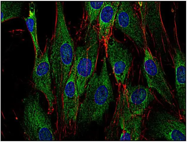 ICC/IF analysis of human primary fibroblasts using GTX79891 SOS1 antibody [SOS-01]. Green : Primary antibody Red : Actin Blue : DAPI