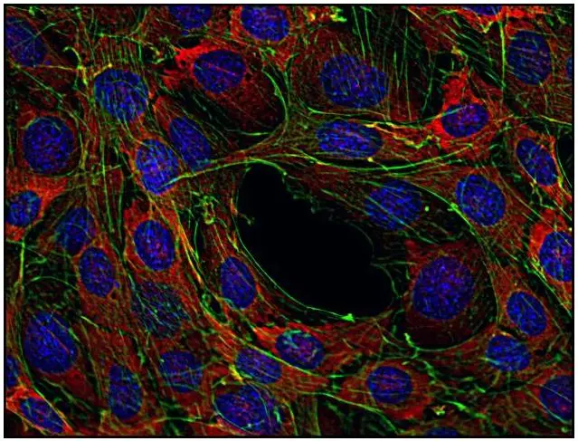 ICC/IF analysis of mouse transformed fibroblasts using GTX79891 SOS1 antibody [SOS-01]. Green : Actin Red : Primary antibody Blue : DAPI