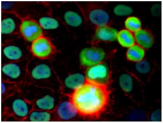 ICC/IF analysis of HeLa cells using GTX79937 Ku80 antibody [MEM-54]. Green : Primary antibody Red : Actin Blue : DAPI