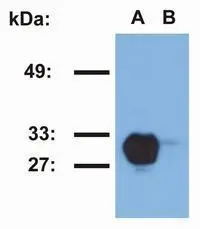 Western blotting analysis of HLA-DR1 in Raji (A) and Jurkat (B) cell lines using MEM-267 antibody.