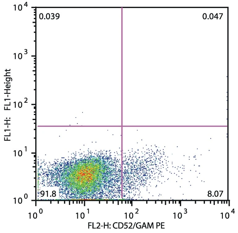 Flow cytometry analysis of CD52 in patients suffering with Acute Lymphoblastic Leukemia (anti-human CD52 (HI186) (GTX22576); detection by Goat anti-mouse IgG2b PE). CD52 positive cALL (gate leukemic cells)
