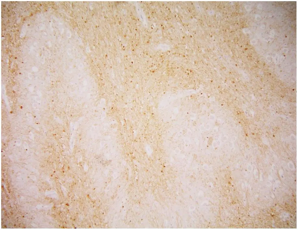 IHC-P analysis of human medulla oblongata using GTX80151 PSMA antibody [GCP-04].