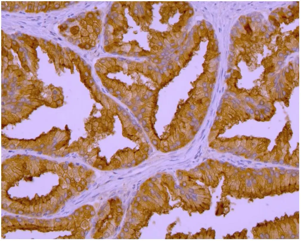IHC-P analysis of human prostate tissue using GTX80151 PSMA antibody [GCP-04].