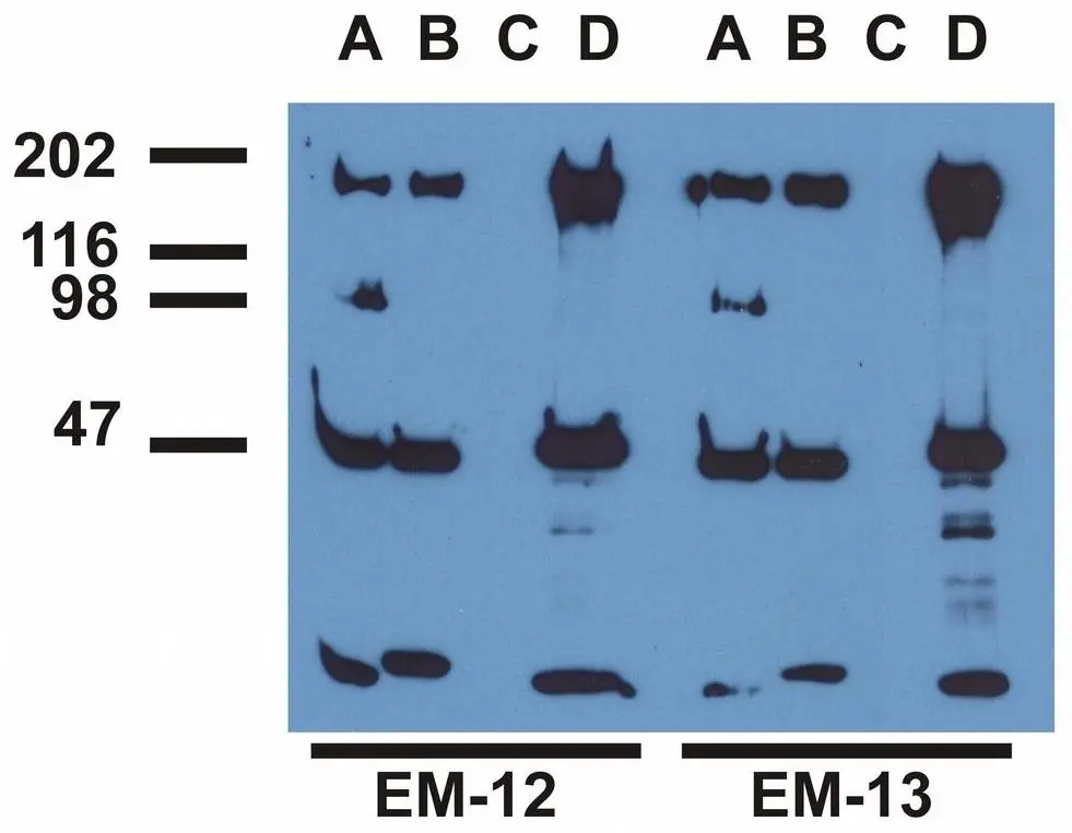 IP analysis of EGF-treated A431 cells using phosphospecific EGFR antibodies ,GTX80162 (A), GTX80161 (B) , a commercial anti-EGFR polyclonal antibody(C), and anti-EGFR monoclonal mAb108 (D). The precipitates were immunoblotted with GTX80162 EGFR (phospho Tyr992) antibody [EM-12] or GTX80161 EGFR (phospho Tyr1173) antibody [EM-13] antibody.
