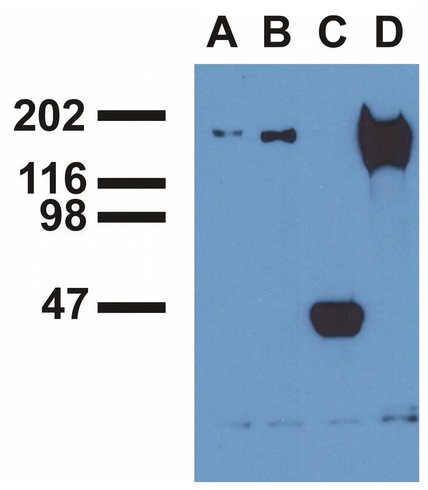IP analysis of EGF-treated A431 cells using phosphospecific EGFR antibodies GTX80162(A), GTX80161(B) , a commercial anti-EGFR polyclonal antibody(C), and anti-EGFR monoclonal mAb108 (D). The precipitates were immunoblotted with a commercial anti-EGFR polyclonal antibody.
