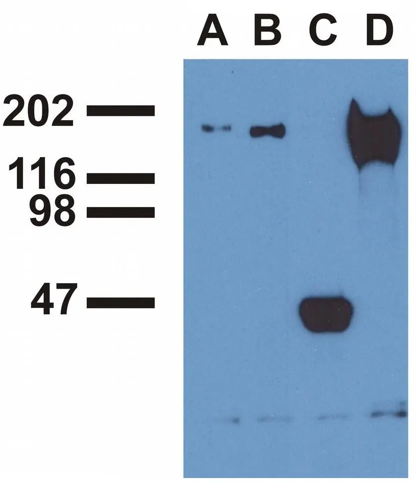 IP analysis of EGF-treated A431 cells using phosphospecific EGFR antibodies ,GTX80162 (A), GTX80161 (B) , a commercial anti-EGFR polyclonal antibody(C), and anti-EGFR monoclonal mAb108 (D). The precipitates were immunoblotted with GTX80162 EGFR (phospho Tyr992) antibody [EM-12] or GTX80161 EGFR (phospho Tyr1173) antibody [EM-13] antibody.