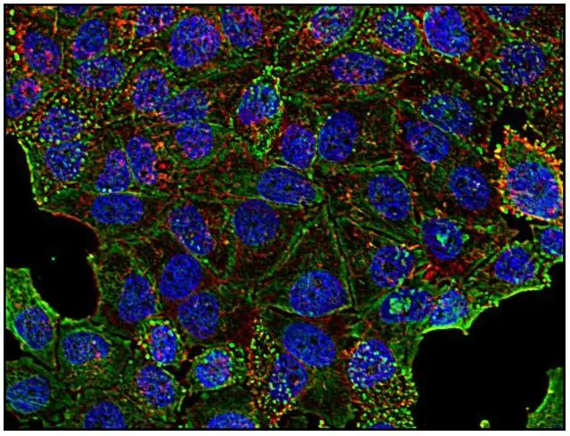 Immunofluorescence staining of clathrin in human HeLa cell line using anti-clathrin (BF-06; green). Actin cytoskeleton decorated by phalloidin (red) and cell nuclei stained with DAPI (blue).