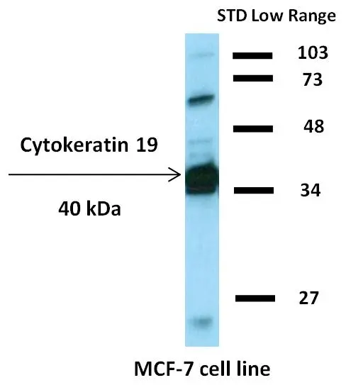 Detection of cytokeratin 19 in MCF-7 cell lysate by mouse monoclonal antibody BA-17.