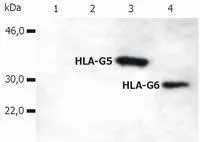 Western Blotting analysis of whole cell lysate of HLA-G stable transfectants (various splice variants) using anti-human HLA-G (5A6G7).