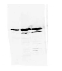 WB analysis of HeLa cell lysate using GTX80387 hnRNP K antibody [3C2]. Dilution : 1:1000