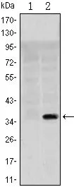 FACS analysis of Jurkat cells using GTX80400 SLC22A1 antibody [2C5]. Green : SLC22A1 Purple : negative control