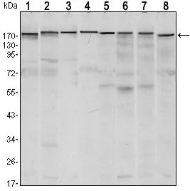 ICC/IF analysis of LOVO cells using GTX80408 SETDB1 antibody [5H6A12]. Green : SETDB1 Red: Actin filaments