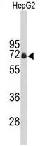 WB analysis of HepG2 cell lysate (35ug/lane) using GTX80503 FBXO3 antibody, C-term.
