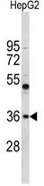 WB analysis of HepG2 cell lysate (35ug/lane) using GTX80506 ELOVL2 antibody, N-term.