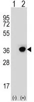 WB analysis of 293 cell lysate (2 ug/lane) either nontransfected (Lane 1) or transiently transfected with the DHRS3(Lane 2) using GTX80507 DHRS3 antibody, Internal.