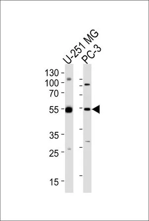 WB analysis of U-251 MG and PC-3 cell using GTX80509 DEK antibody, C-term. Loading : 35ug per lane Dilution : 1:1000