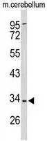 WB analysis of mouse cerebellum tissue lysate (35ug/lane) using GTX80512 PXMP3 antibody, Internal.