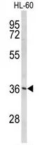WB analysis of HL-60 cell lysate (35ug/lane) using GTX80530 PEX14 antibody, C-term.