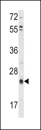 WB analysis of HepG2 cell lysate (35ug/lane) using GTX80547 TIMP3 antibody, Internal.