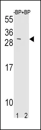 WB analysis of NIH-3T3 cell lysate using GTX80547 TIMP3 antibody, Internal. Lane 1 : pre-incubated without blocking peptide Lane 2 : pre-incubate with blocking peptide