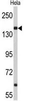 WB analysis of HeLa cell lysate (35ug/lane) using GTX80552 Nup153 antibody, N-term.