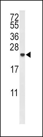 WB analysis of MDA-MB435 cell lysate (35ug/lane) using GTX80555 IL10 antibody, Internal.