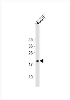 WB analysis of NCCIT whole cell lysate using GTX80558 HMGA1 antibody, C-term. Loading : 20 microg per lane Dilution : 1:1000
