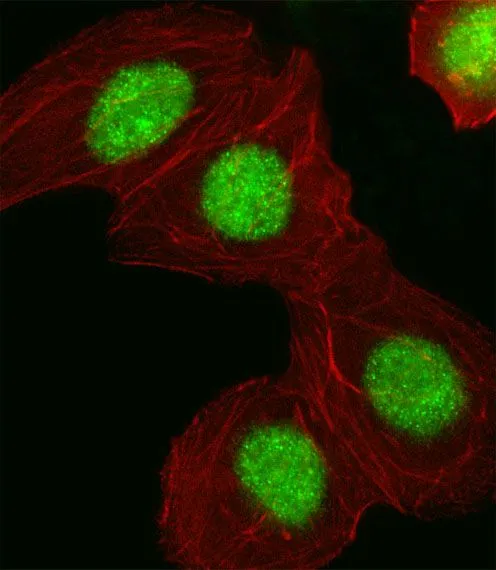 ICC/IF analysis of A549 cells using GTX80558 HMGA1 antibody, C-term. Green : HMGA1 Red : Actin filament Fixation : 4% paraformaldehyde (PFA) (20 min) Permeabilization : Triton X-100 (0.1%, 10 min) Dilution : 1:25