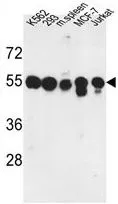 WB analysis of K562, 293, mouse spleen tissue, MCF-7, Jurkat cell lysate (35ug/lane) using GTX80567 PPM1H antibody, Internal.