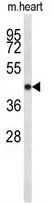 WB analysis of mouse heart tissue lysate (35ug/lane) using GTX80572 CDC2L6 antibody, Internal.