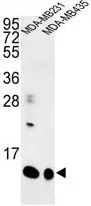 WB analysis of MDA-MB231, MDA-MB435 cell lysate (35ug/lane) using GTX80592 SPRR1B antibody, C-term.
