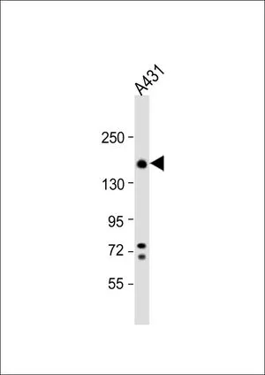 WB analysis of A431 whole cell lysate using GTX80593 Integrin alpha 2 antibody, C-term. Loading : 20 microg per lane Dilution : 1:1000