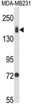 WB analysis of MDA-MB231 cell lysate (35ug/lane) using GTX80593 Integrin alpha 2 antibody, C-term.