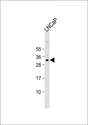 WB analysis of LNCaP whole cell lysate using GTX80628 Nkx3.1 antibody, Internal. Loading : 20 microg per lane Dilution : 1:8000