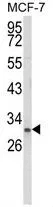 WB analysis of MCF-7 cell lysate (35ug/lane) using GTX80628 Nkx3.1 antibody, Internal.