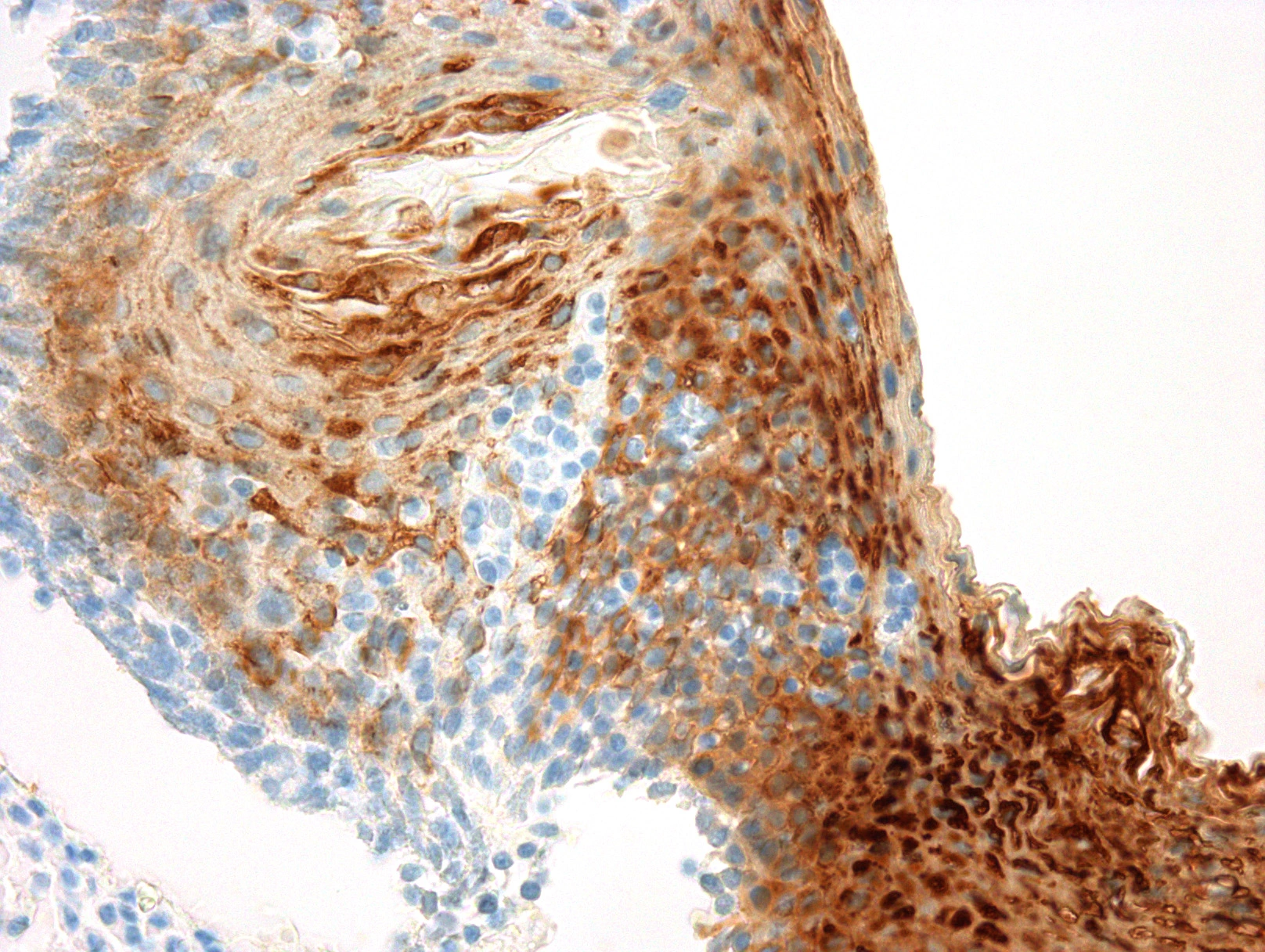 IHC-P analysis of human skin tissue using GTX80652 Cytokeratin 13 antibody [KS-1A3].