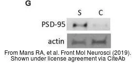 The data was published in the journal Front Mol Neurosci in 2019. PMID: 31040768