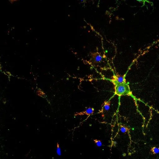 ICC/IF analysis of cells using GTX80682 PSD95 antibody [7E3-1B8].