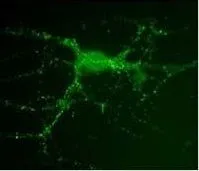 ICC/IF analysis of rat hippocampal cells using GTX80682 PSD95 antibody [7E3-1B8].