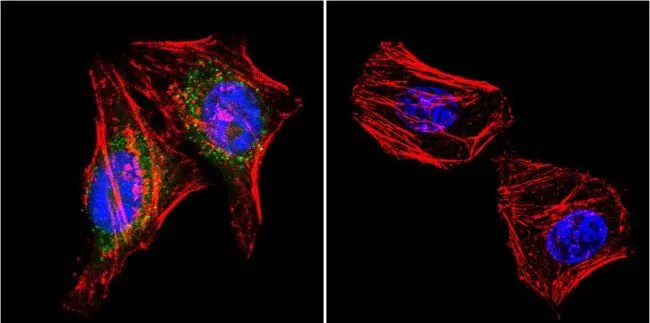 ICC/IF analysis of HeLa cells using GTX80682 PSD95 antibody [7E3-1B8]. Cells were probed without (right) or with(left) an antibody. Green : Primary antibody Blue : Nuclei Red : Actin Fixation : formaldehyde Dilution : 1:20 overnight at 4oC