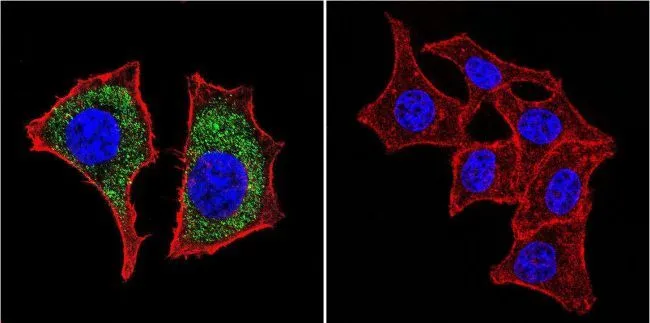 ICC/IF analysis of HeLa cells using GTX80686 beta Catenin antibody [9F2]. Cells were probed without (right) or with(left) an antibody. Green : Primary antibody Blue : Nuclei Red : Actin Fixation : formaldehyde Dilution : 1:20 overnight at 4oC