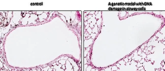IHC-P analysis of postnatal mouse (PN19) lung sections using GTX80694 Histone H2A.XS139ph (phospho Ser139) antibody [3F2]. Increased staining intensity was observed in a genetic mouse model with DNA damage in airway cells. Antigen retrieval : heat induced epitope retrieval (HIER) method with sodium citrate buffer (pH 6.0) Fixation : 4% Paraformaldehyde Dilution : 1:400
