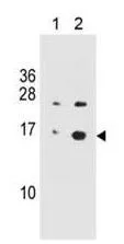 WB analysis of Jurkat cell untreated (Lane 1) and Jurkat cell stimulated with staurosporine (Lane 2) using GTX80694 Histone H2A.XS139ph (phospho Ser139) antibody [3F2]. Dilution : 1 microg/ml
