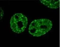 ICC/IF analysis of gamma irradiated HeLa cells using GTX80694 Histone H2A.XS139ph (phospho Ser139) antibody [3F2].