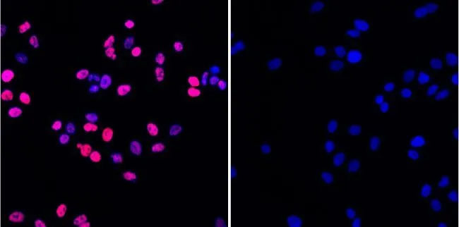 ICC/IF analysis of A549 cells treated with vehicle (control; 0.1% DMSO in media) or with 50 microM etoposide for 1 hour using GTX80694 Histone H2A.XS139ph (phospho Ser139) antibody [3F2]. Red : Primary antibody Blue : Nuclei