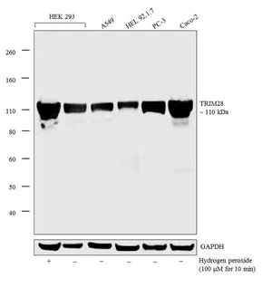 WB analysis of nuclear enriched extracts (30 microg lysate) of HEK 293 treated with Hydrogen peroxide (100um Hydrogen peroxide for 10 min) (Lane 1), HEK 293 (Lane 2), A549 (Lane 3), HEL 92.1.7 (Lane 4), PC-3 (Lane 5), and Caco-2 (Lane 6) using GTX80695 KAP1 antibody [20C1]. Dilution : 1 microg/ml